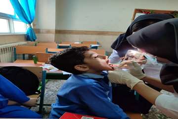 غربالگری سلامت دهان و دندان در مدارس توسط دانشجویان دانشکده دندانپزشکی